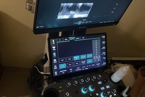 A képen a radiológiai ultrahang látható